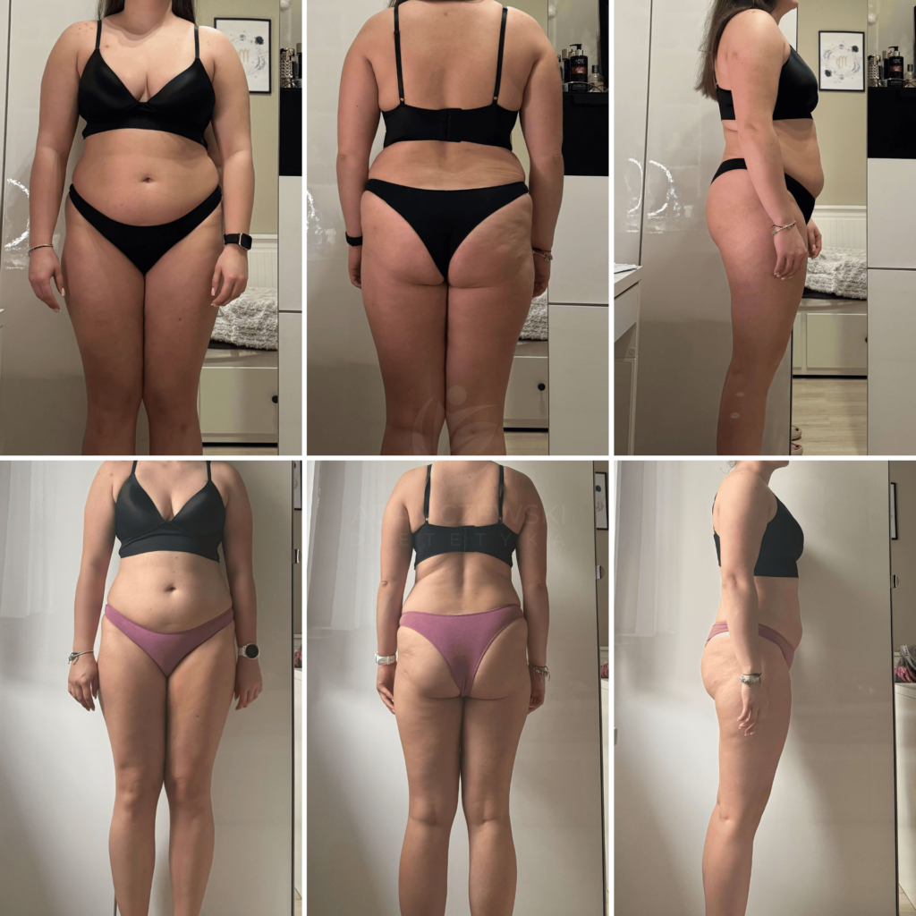 Dieta crossfit. Odchudzanie crossfit. Jak schudnąć crossfit. Jak schudnąć 9 kg w 6 miesięcy. Dietetyk. Zuzanna Budzisz B2