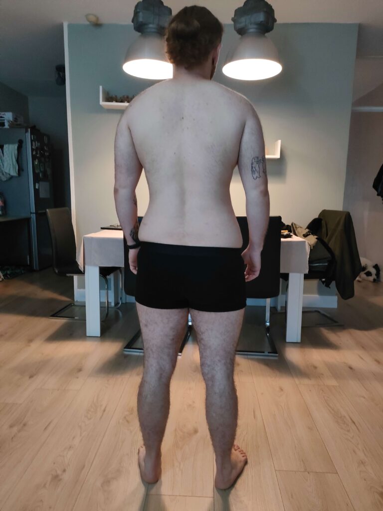 Dieta po korekcie płci. Metamorfoza Alana