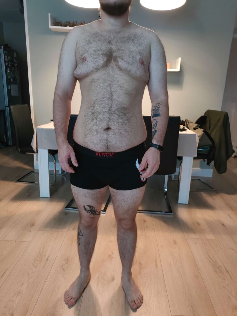 Dieta po korekcie płci. Metamorfoza Alana